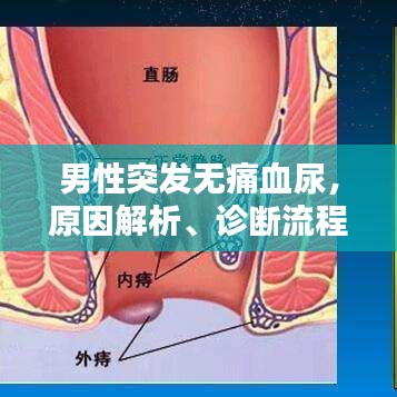 男性突发无痛血尿，原因解析、诊断流程与治疗方法全攻略