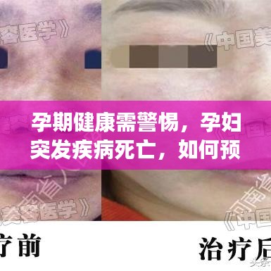 孕期健康需警惕，孕妇突发疾病死亡，如何预防悲剧再次发生？