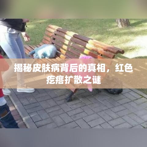 揭秘皮肤病背后的真相，红色疙瘩扩散之谜