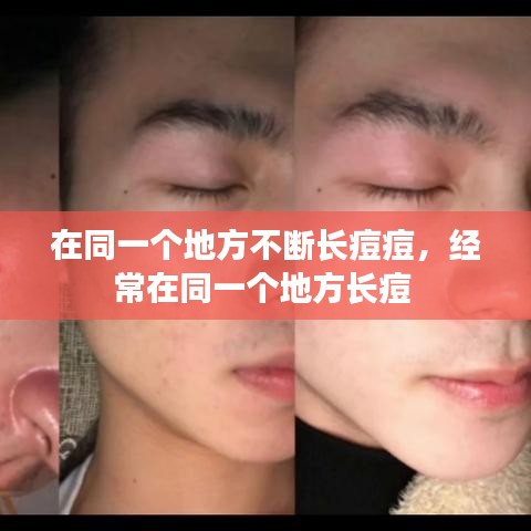 在同一个地方不断长痘痘，经常在同一个地方长痘 
