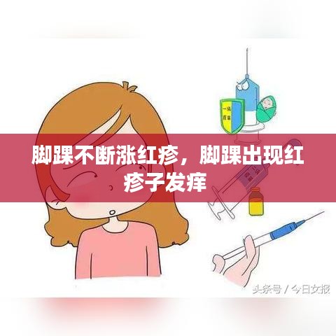 脚踝不断涨红疹，脚踝出现红疹子发痒 