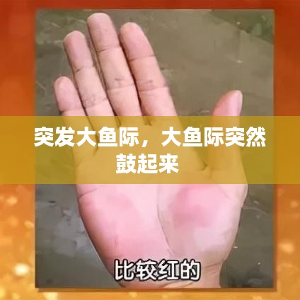 突发大鱼际，大鱼际突然鼓起来 