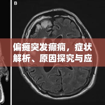 偏瘫突发癫痫，症状解析、原因探究与应对策略