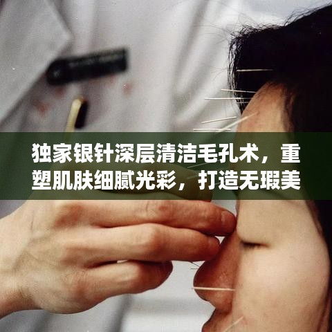 独家银针深层清洁毛孔术，重塑肌肤细腻光彩，打造无瑕美肌