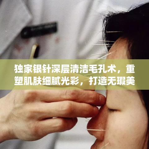 独家银针深层清洁毛孔术,重塑肌肤细腻光彩,打造无瑕美肌
