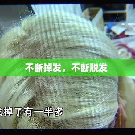 不断掉发，不断脱发 