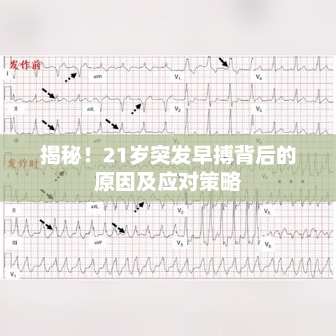 揭秘！21岁突发早搏背后的原因及应对策略