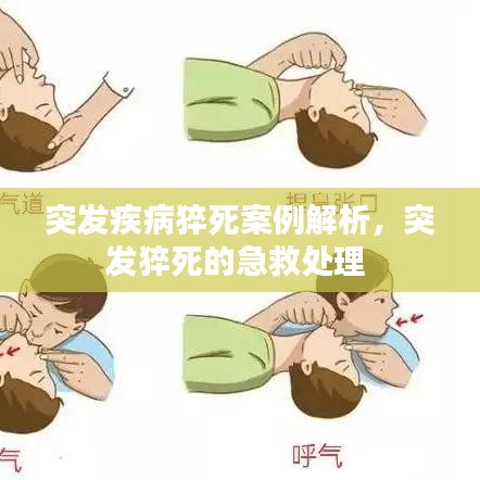 突发疾病猝死案例解析,突发猝死的急救处理