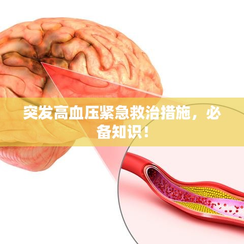 突发高血压紧急救治措施，必备知识！