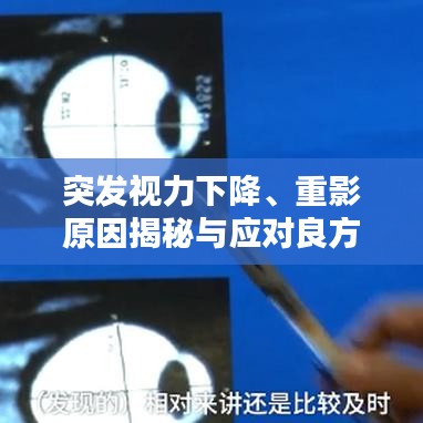 突发视力下降、重影原因揭秘与应对良方