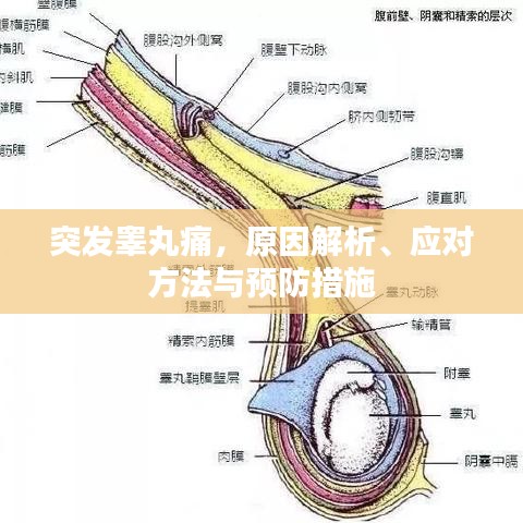 突发睾丸痛，原因解析、应对方法与预防措施
