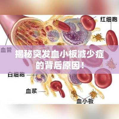 揭秘突发血小板减少症的背后原因！