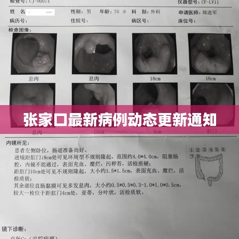 张家口最新病例动态更新通知