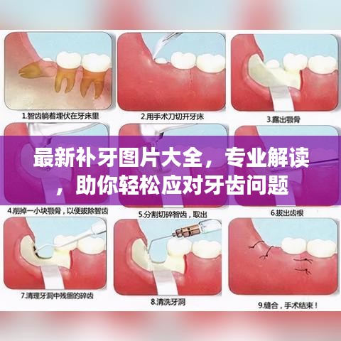最新补牙图片大全，专业解读，助你轻松应对牙齿问题
