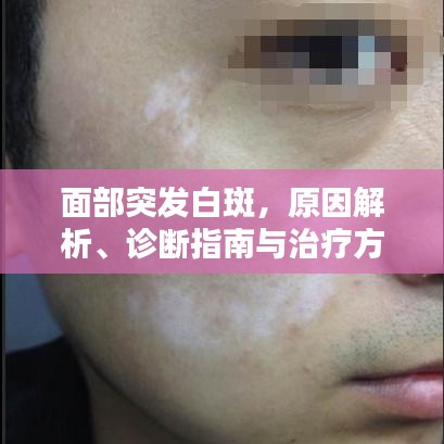 面部突发白斑，原因解析、诊断指南与治疗方法全攻略