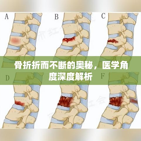 骨折折而不断的奥秘，医学角度深度解析