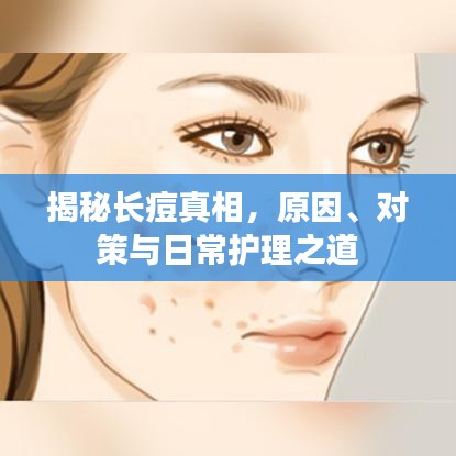 揭秘长痘真相，原因、对策与日常护理之道
