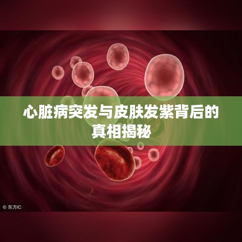 心脏病突发与皮肤发紫背后的真相揭秘