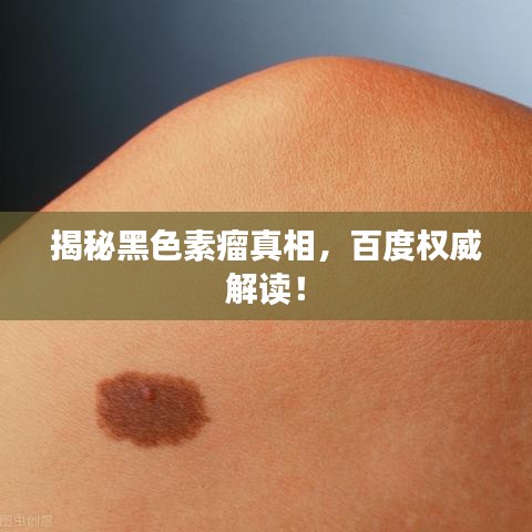 揭秘黑色素瘤真相,百度权威解读!