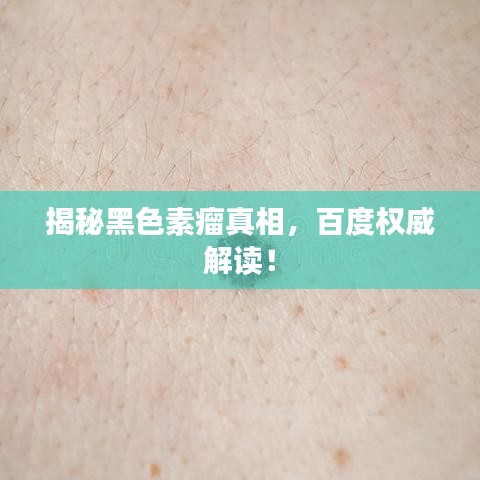 揭秘黑色素瘤真相,百度权威解读!